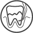 Cirugía periodontal