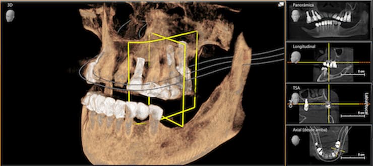 Última tecnología para diagnosticar el mejor tratamiento a realizar