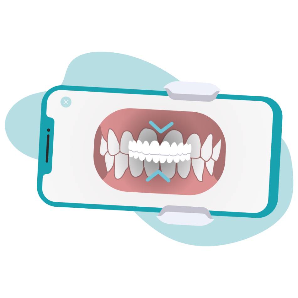 2 - Escanea tu sonrisa