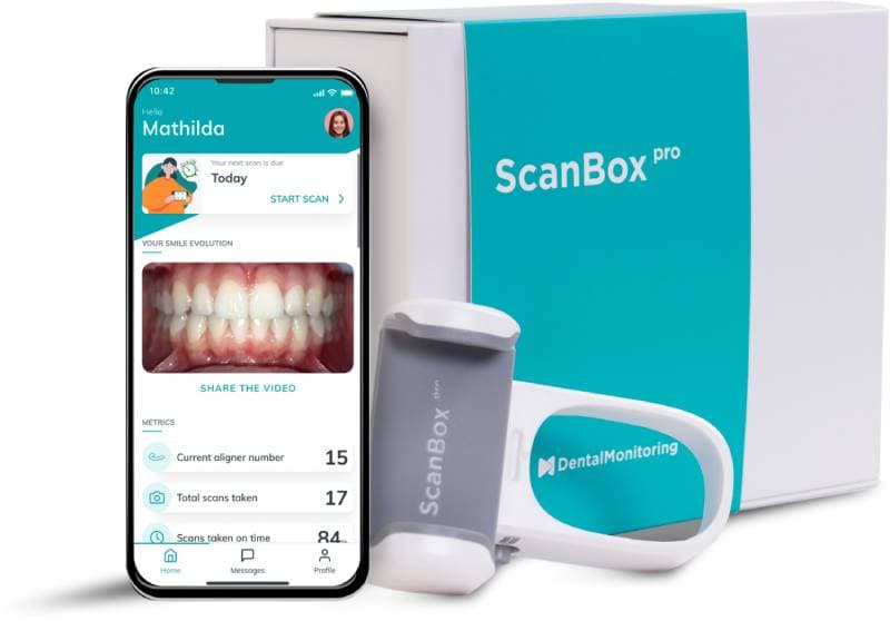 ScanBox<sup>pro</sup> e imagen de la aplicación <i>Dental Monitoring</i>
