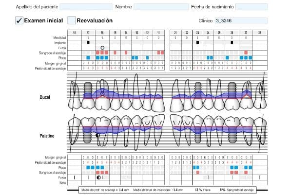 periodontograma
