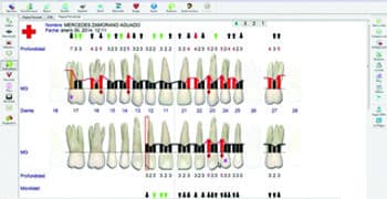 Sonda Florida Probe