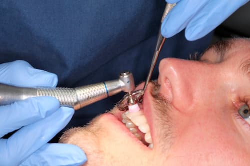 2. Higiene dental y revisión