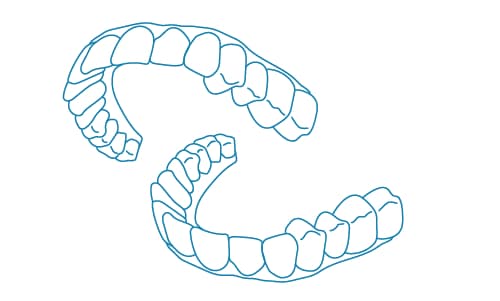 3. Fabricación de alineadores