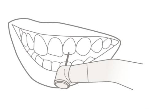 4. Preparación