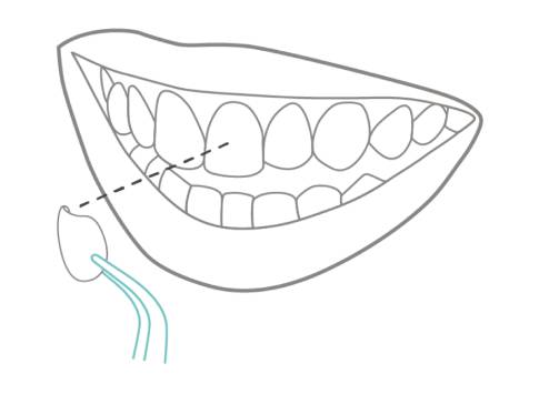6. Cementado