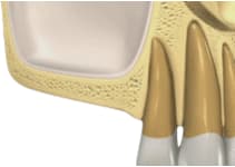 1. Estudio del caso y CBCT