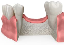 1. Estudio del caso y CBCT