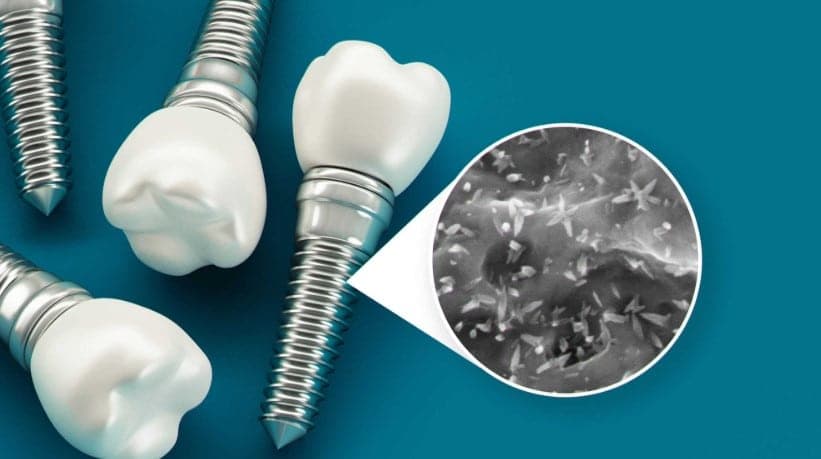 La nanotecnología en odontología