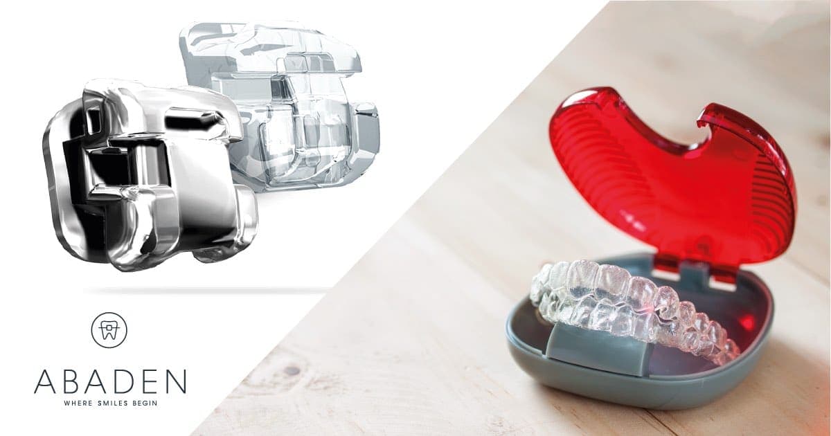 ¿Qué ortodoncia me conviene: Damon o Invisalign?