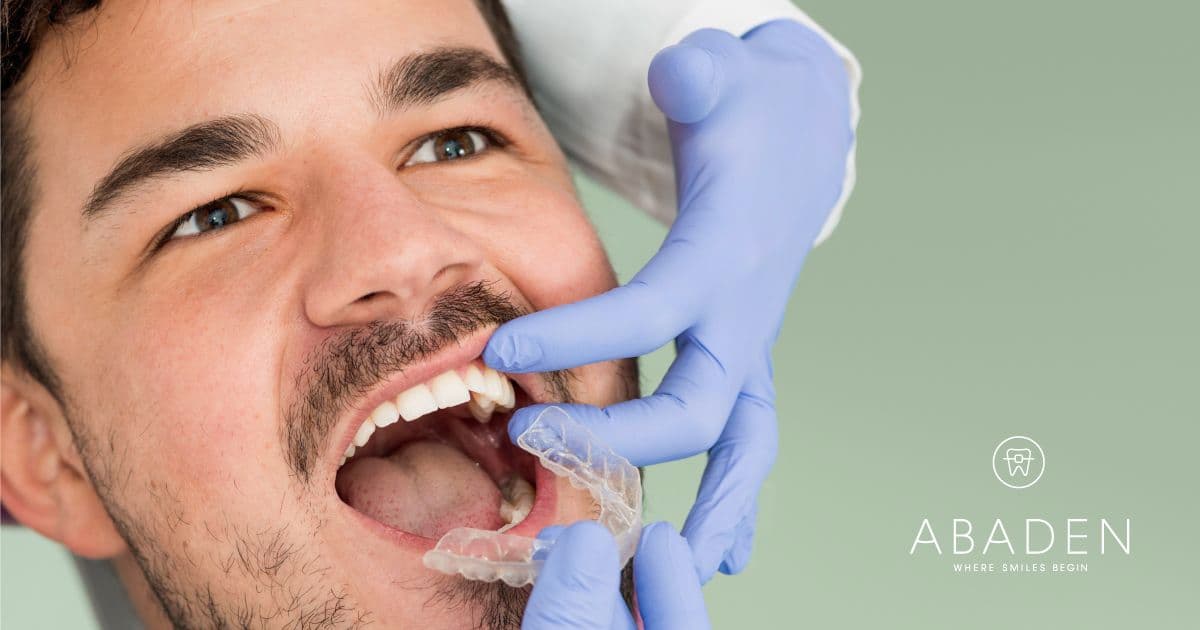 Opiniones Invisalign