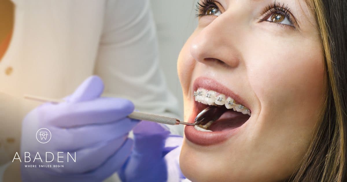 Razones por las que usar ortodoncia en adultos