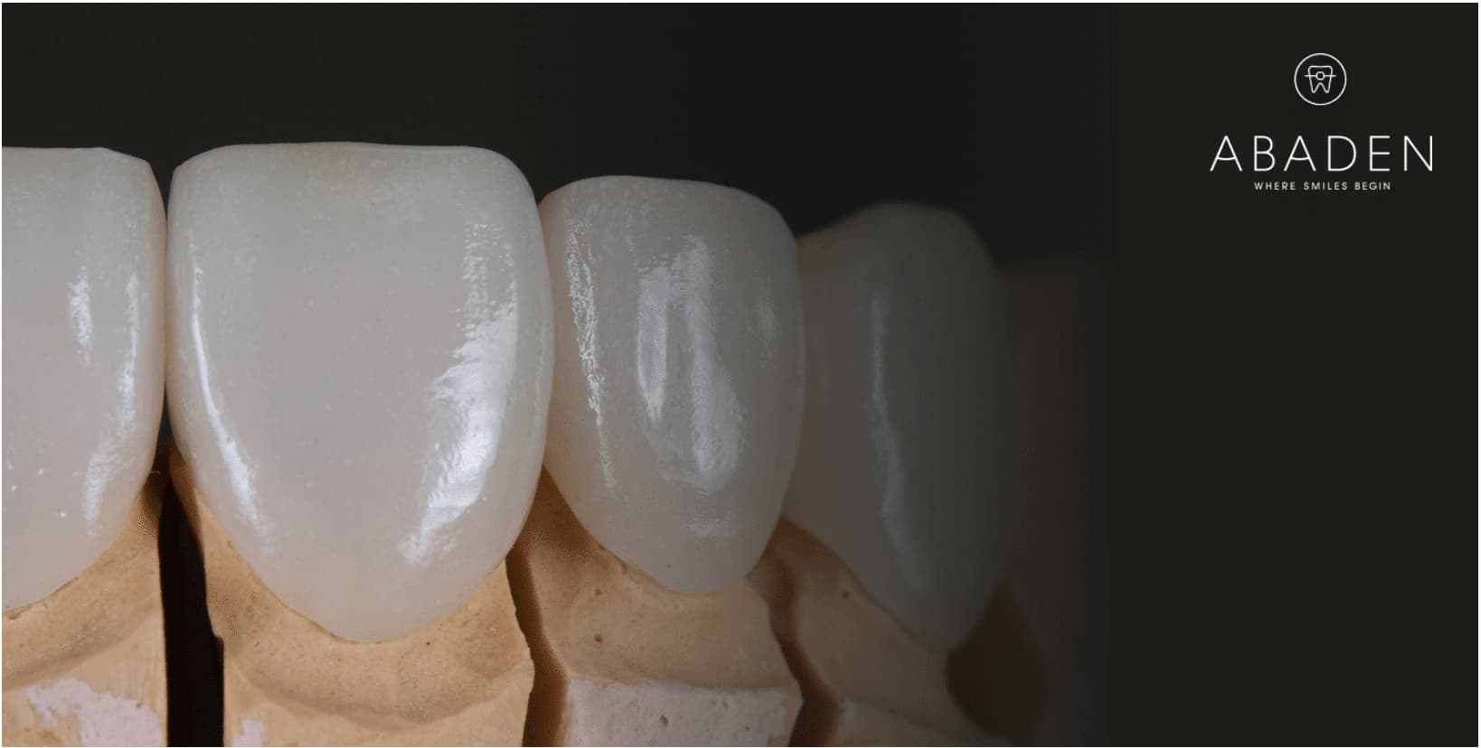 ¿Cuál es el precio de carillas dentales?