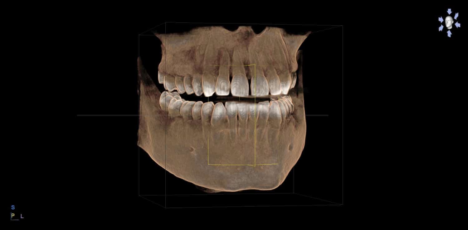Ventajas de la radiología 3D