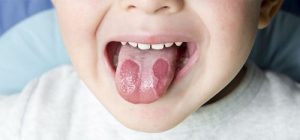 Lengua geografica