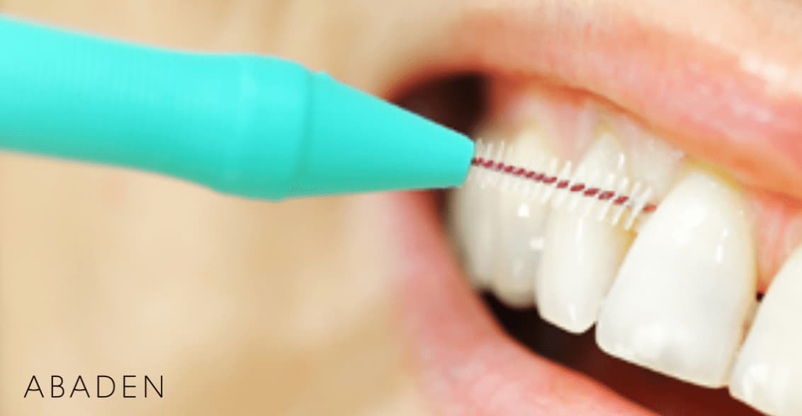 Cepillos interproximales ¿Cuándo utilizarlos?