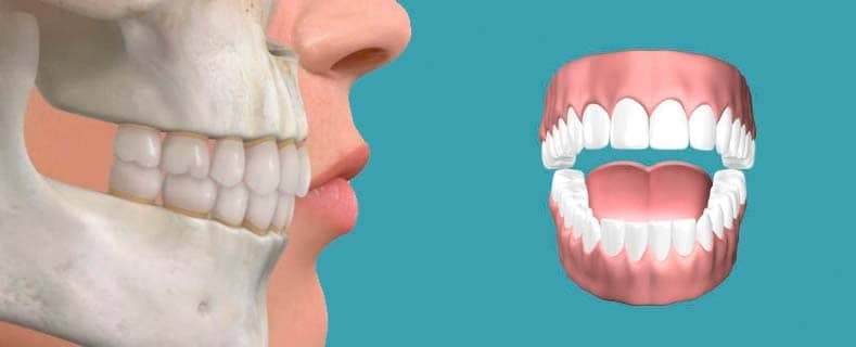 Tipos de oclusión dental: ¿cómo es la posición de los dientes ideal?