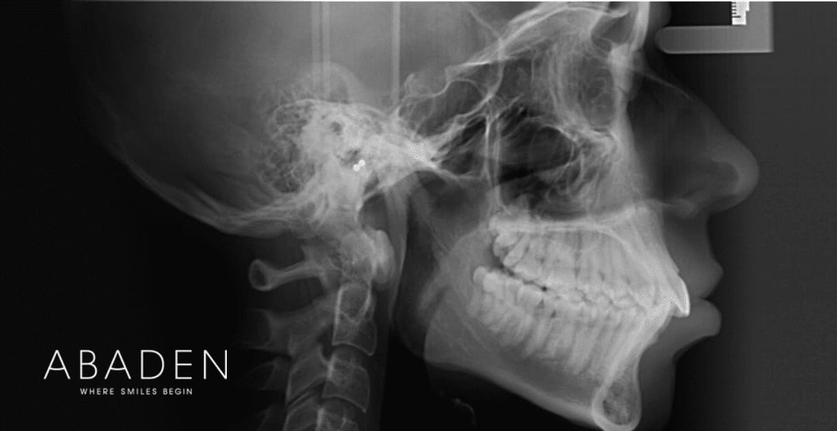 Cómo es una telerradiografía