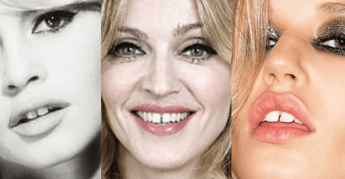 ¿Qué es un diastema y cuáles son sus causas?