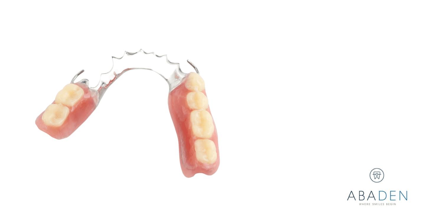 Diferencia entre prótesis dental fija y removible