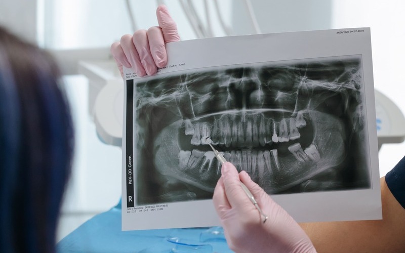Precio estudio inicial de Invisalign