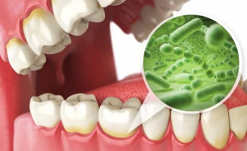 ¿Qué es la microflora oral?