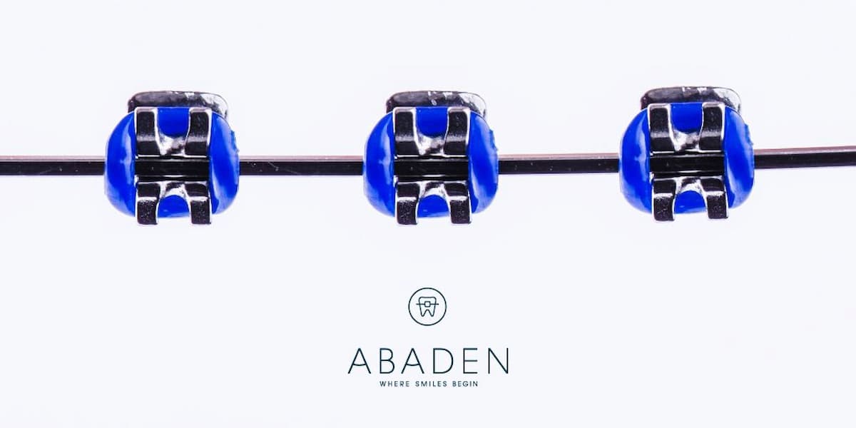 Brackets metálicos: ¿Son los mejores para mí? ¿Cuál es su precio?