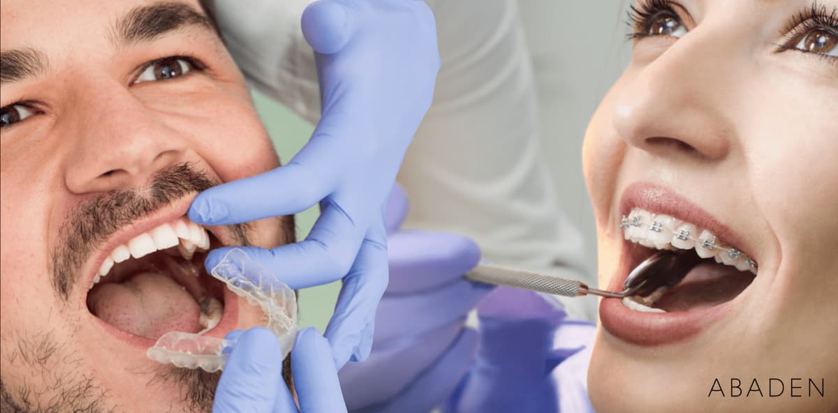 ¿Cuáles son los precios de los distintos tratamientos de ortodoncia?