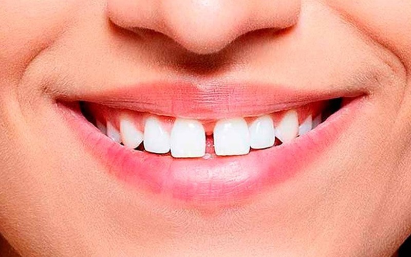 Dentistas en Barberà del vallès