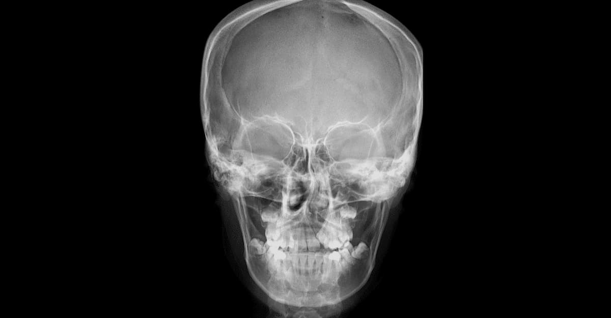 Qué es la cirugía maxilofacial