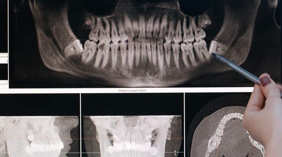 Qué hace un periodoncista