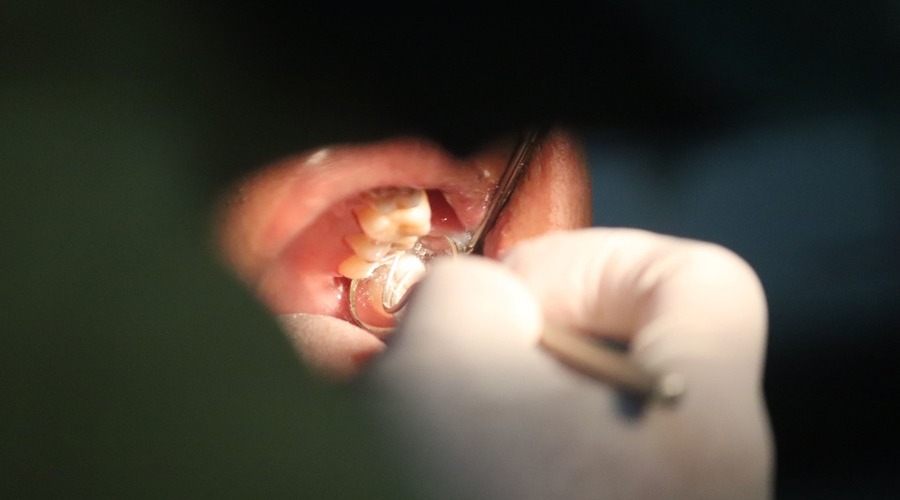 Cuándo es necesario hacer una reconstrucción dental