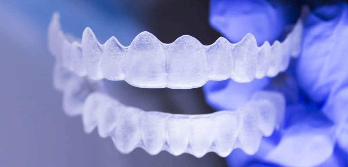Fases de un tratamiento con Invisalign