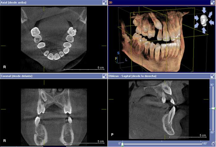 tac dental