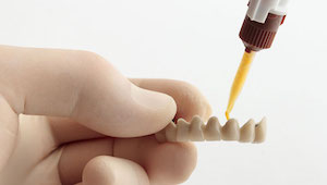 puente dental