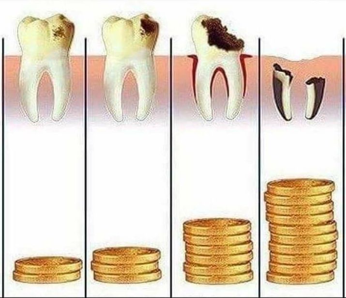 precios de los tratamientos dentales 2