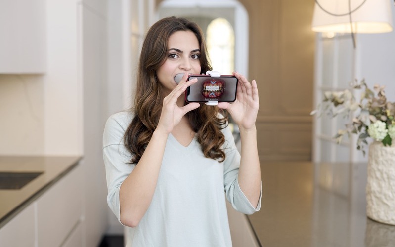 Ortodoncia con Dental Monitoring