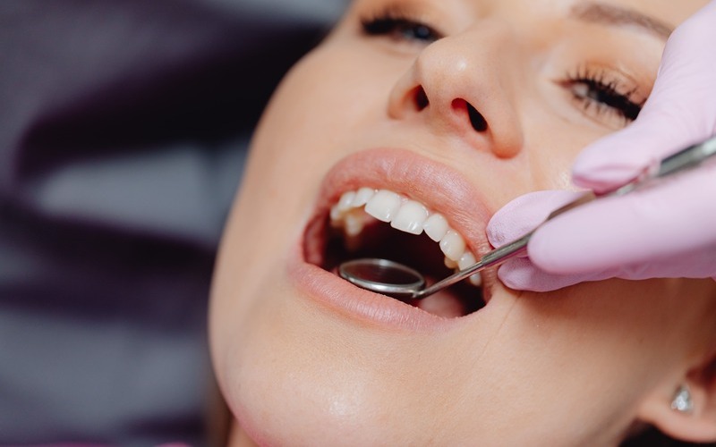 ¿Qué es el stripping dental? ¿En qué casos se debe hacer?