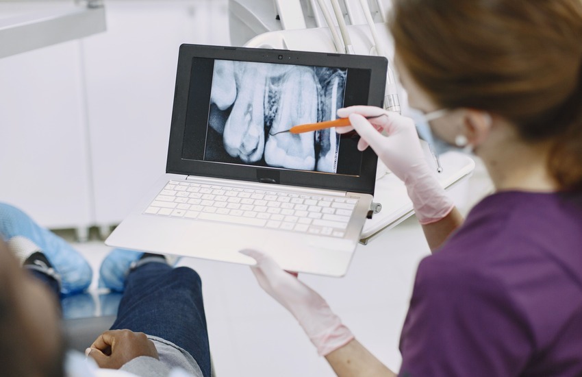 Troneras dentales: causas, tratamientos y prevención