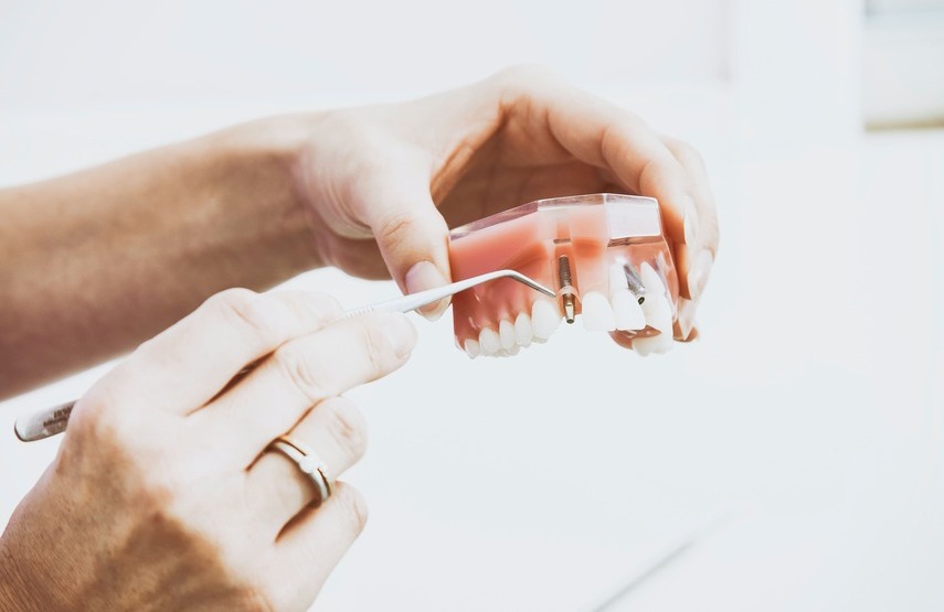 Rechazo de un implante dental: principales síntomas y causas